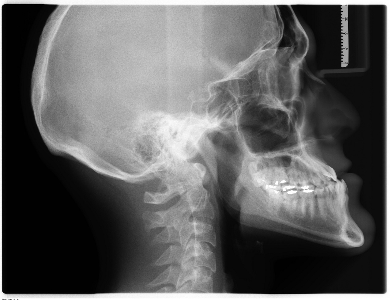 Hoe gebruikt de medische wetenschap AI voor diagnoses?