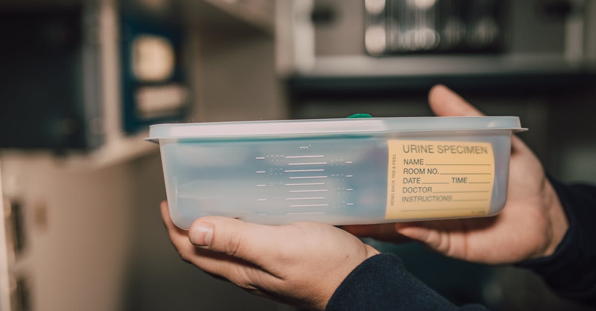 Waarom is er veel schuim in mijn urine?