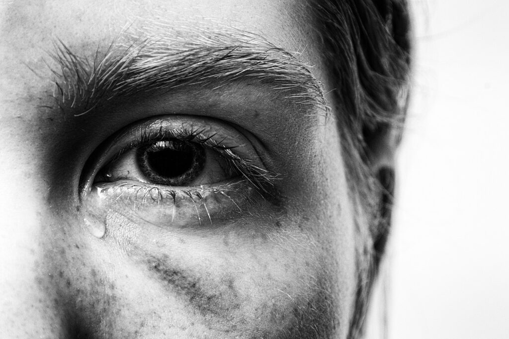 Waarom krijg ik zoveel blauwe plekken? Ontdek de oorzaken!