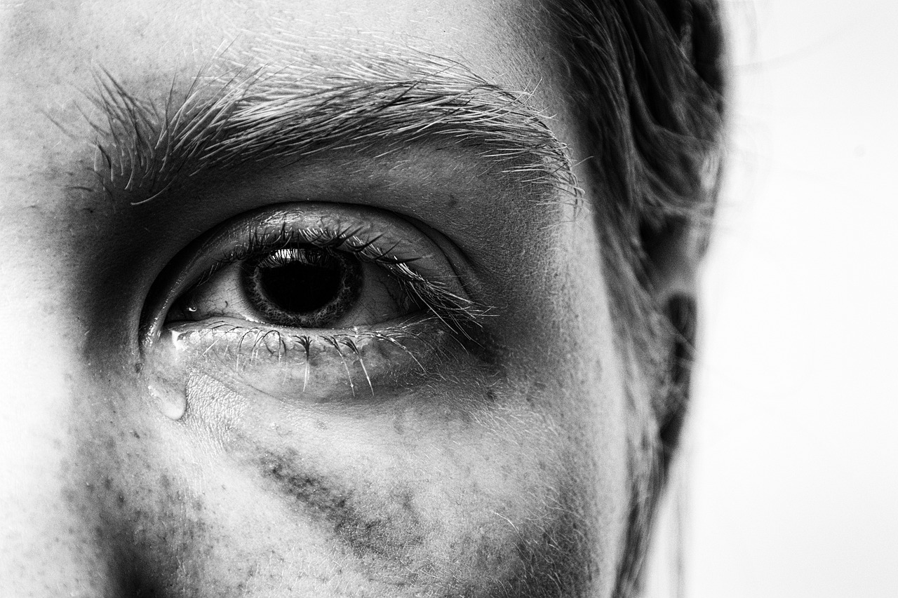 Waarom krijg ik zoveel blauwe plekken? Ontdek de oorzaken!