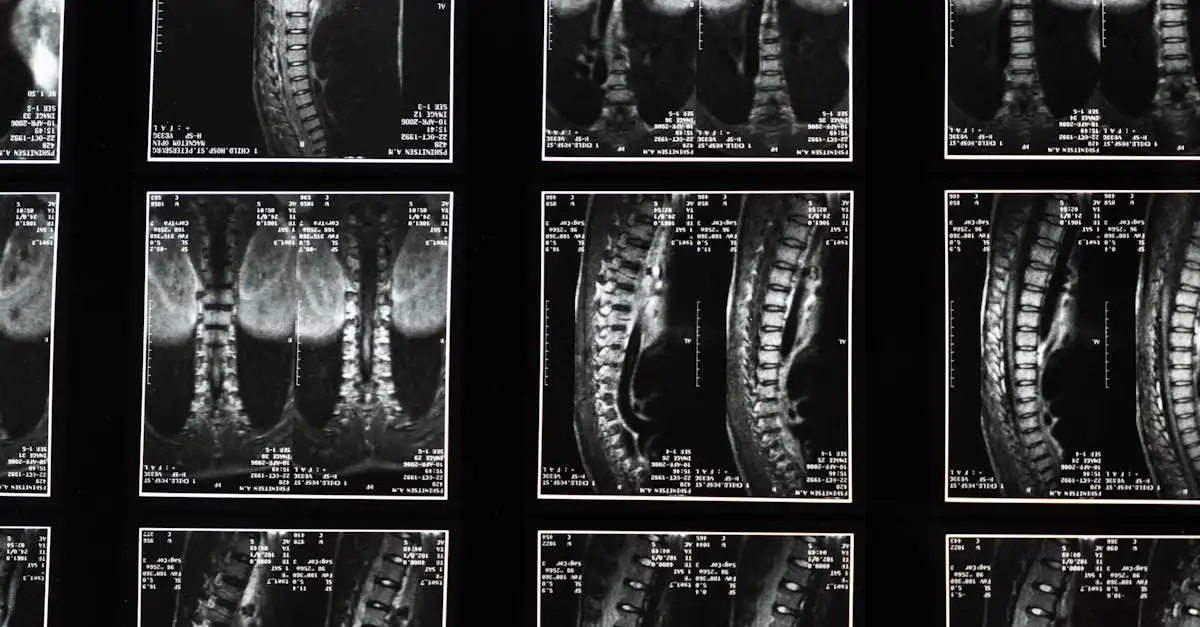 Hoe heeft de MRI de diagnostiek veranderd?